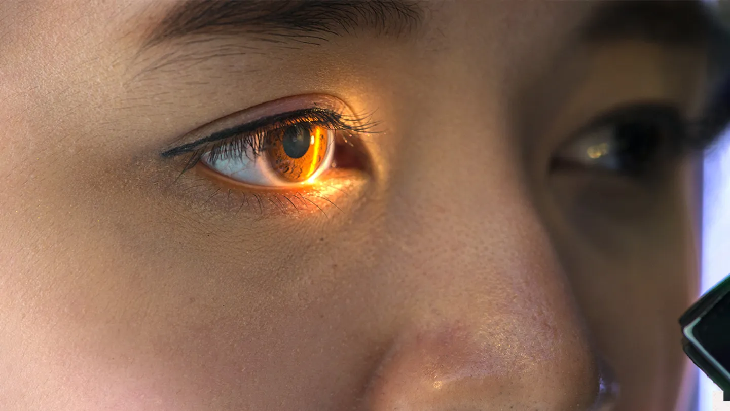 what your retina says about your health 1440x810 1