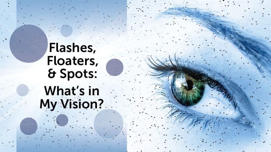 Flashes Floaters and Spots Whats in my Vision 1024x576 2